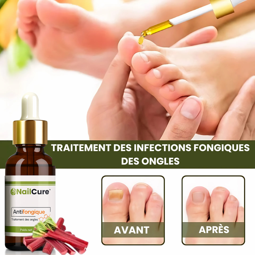 MycoDrop™ Gouttes Antifongiques Puissantes | Élimine 90 % des champignons des ongles en 7 jours!