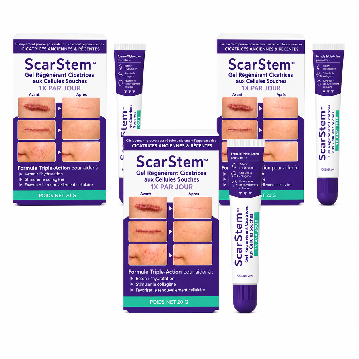 ScarStem™ Gel Régénérant Cicatrices aux Cellules Souches | Effacez cicatrices, brûlures et vergetures en 7 jours !