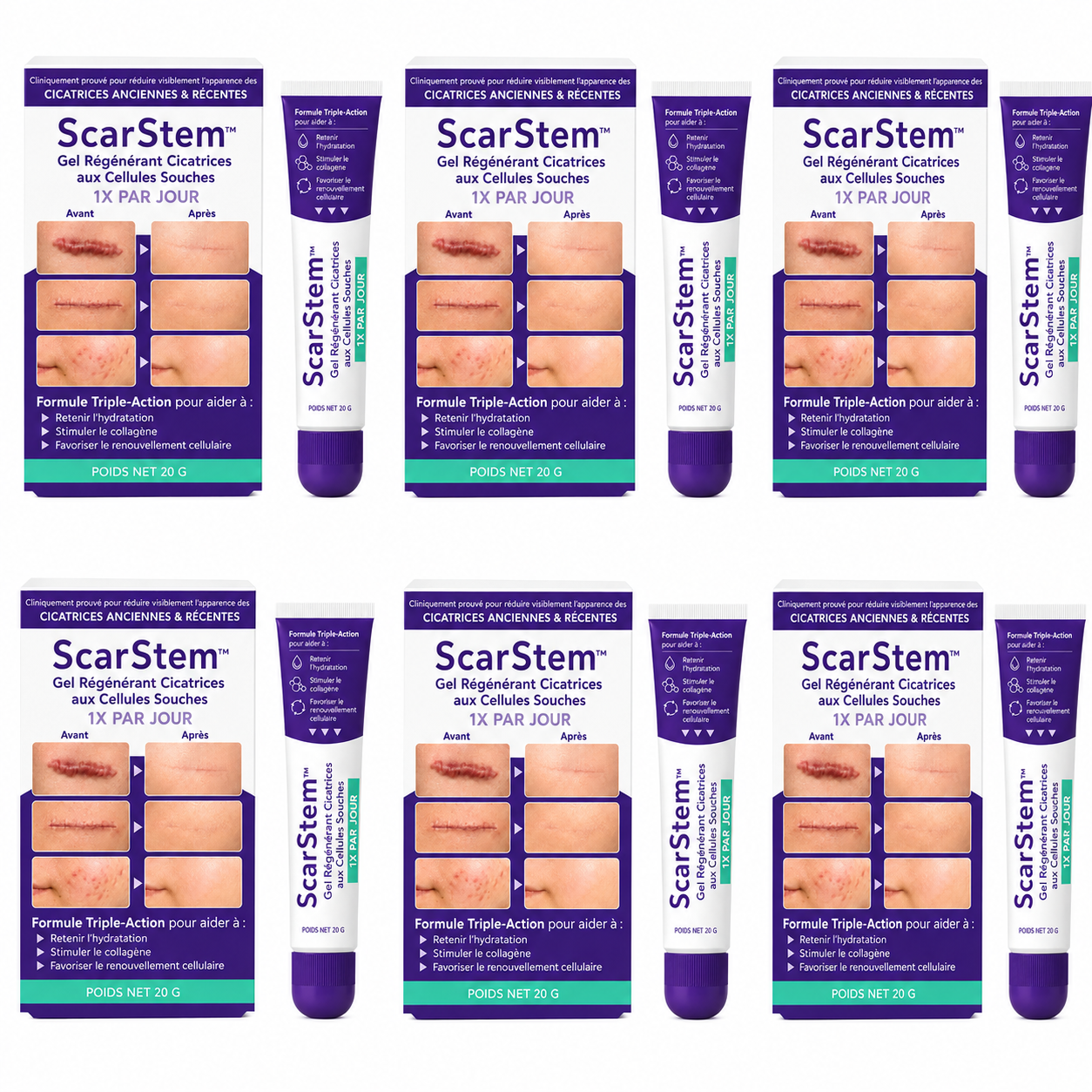 ScarStem™ Gel Régénérant Cicatrices aux Cellules Souches | Effacez cicatrices, brûlures et vergetures en 7 jours !