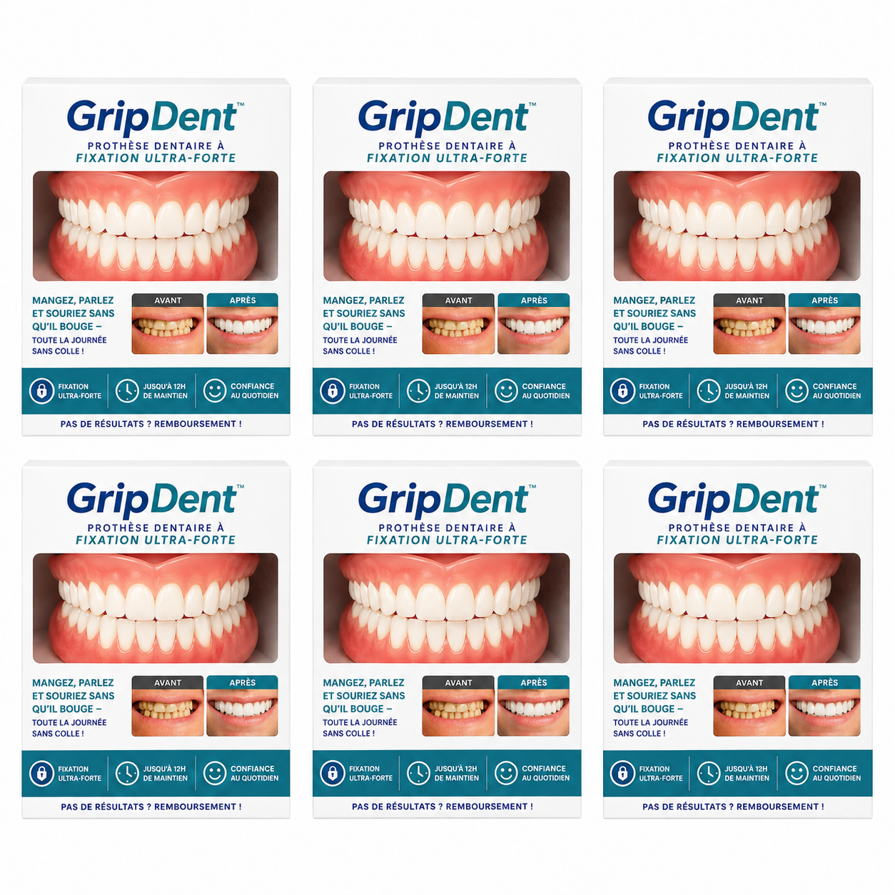 GripDent™ Prothèse Dentaire à Fixation Ultra-Forte | Mangez, parlez et souriez sans qu’il bouge – toute la journée sans colle!