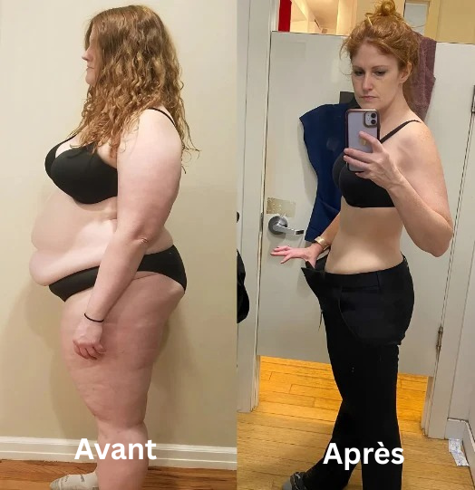 MagnaSlim™ Boucles d’Oreilles Thérapeutiques | Éliminent la graisse, activent la détox et affinent votre coprs!