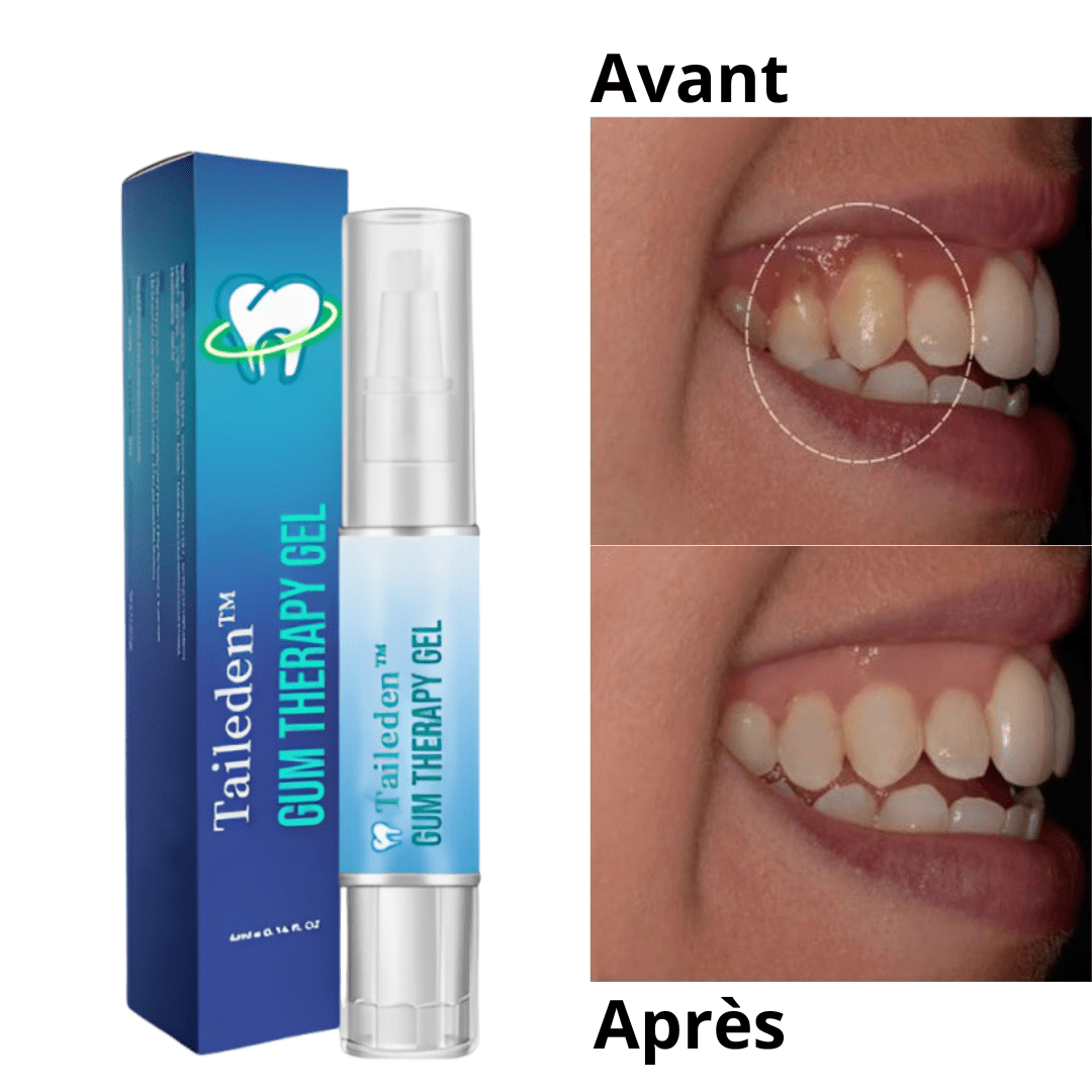 Taileden™ Gel Soin et Réparation des Gencives | Faites repousser vos gencives en 3 minutes!