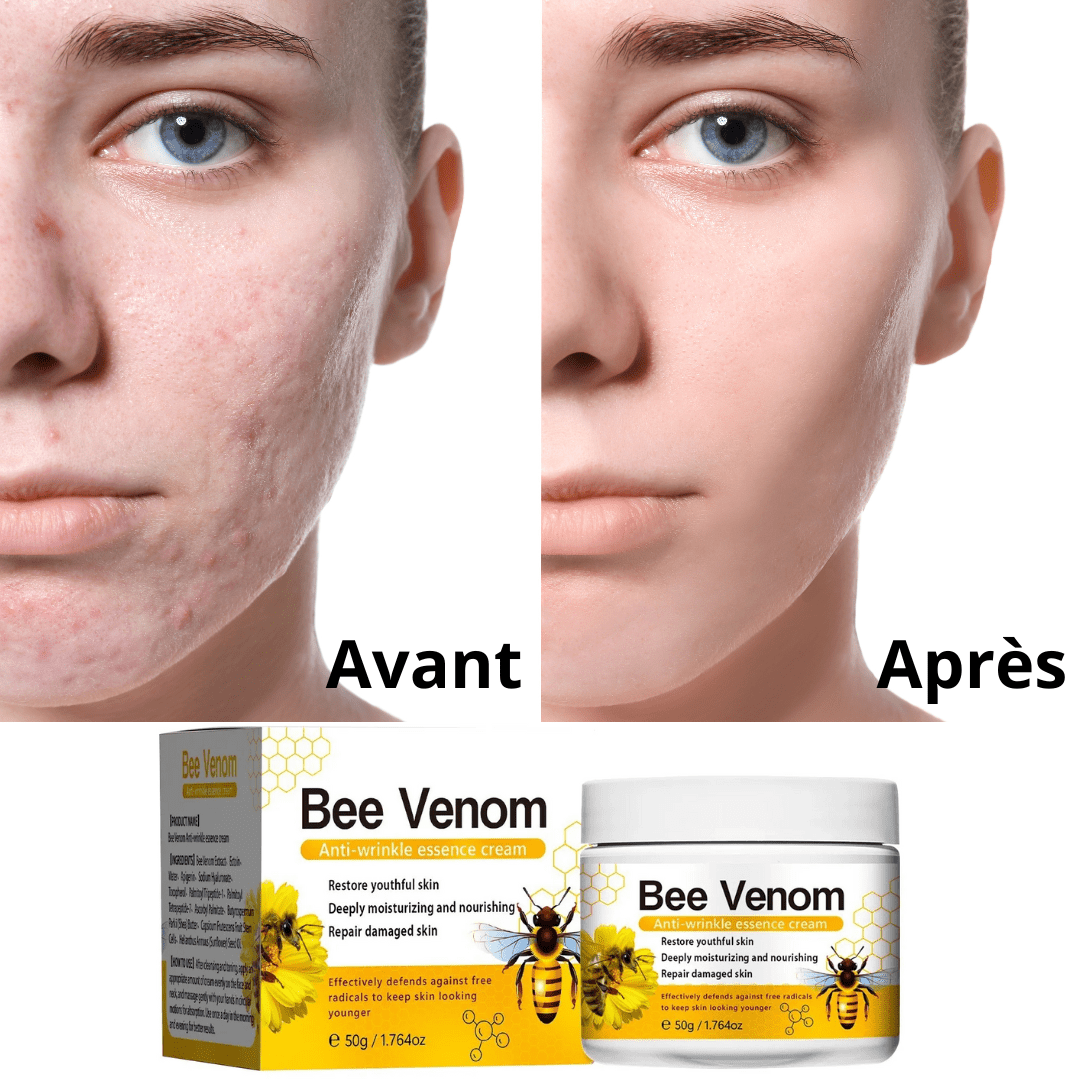 Crème Réparatrice au Venin d'Abeille | Élimine les problèmes de peau en 10 minutes!