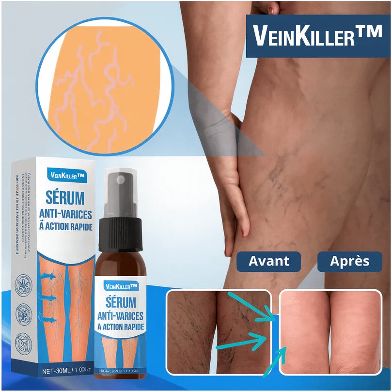 VeinKiller™ Sérum Anti-Varices à Action Rapide | Efface 95 % des varices en 4 jours, sans bas ni chirurgie!