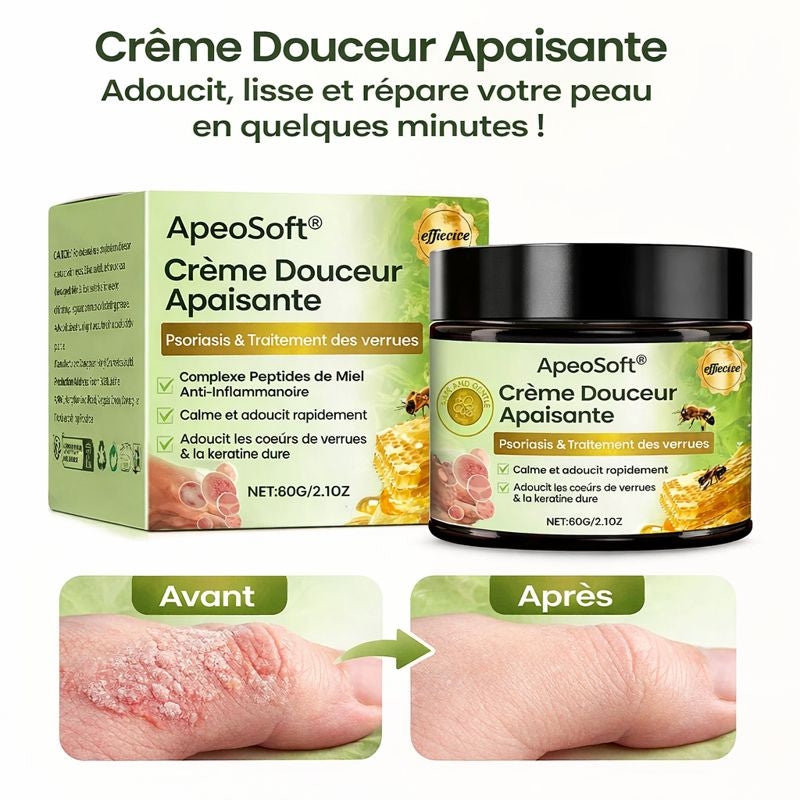 ApeoSoft™ Crème Douceur Apaisante | Adoucit, lisse et répare votre peau en quelques minutes !