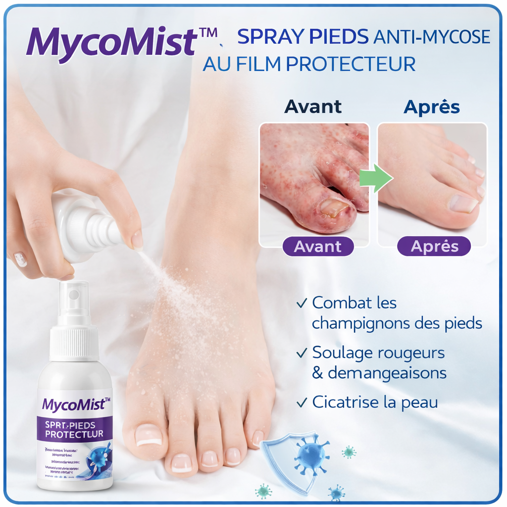MycoMist™ Spray Pieds Anti-Mycose au Film Protecteur | Éliminez les champignons en 48h chrono!