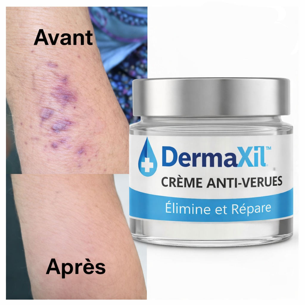 DermaXil™ Crème Anti-Verrues | Élimine verrues, tumeurs cutanées et taches noires dès la 1ʳᵉ application – sans chirurgie, sans cicatrice!