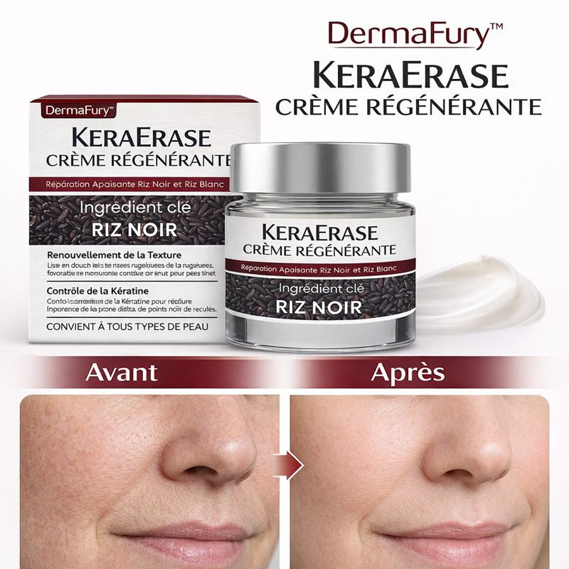 DermaFury™ KeraErase Crème Régénérante | Efface les rides profondes et rajeunit la peau en 7 minutes !
