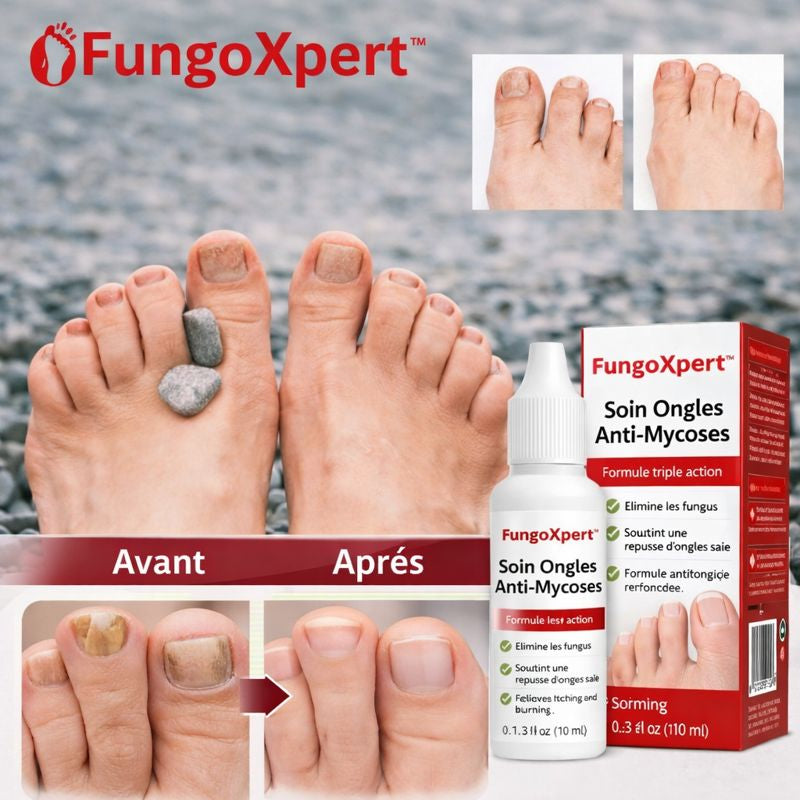 FungoXpert™ Soin Ongles Anti-Mycoses | Détruisez les champignons et retrouvez des ongles sains en 7 jours !