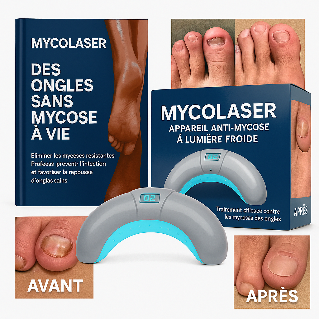 MycoLaser™ Appareil Anti-Mycose à Lumière Froide | Élimine les champignons en 3 jours sans douleur!
