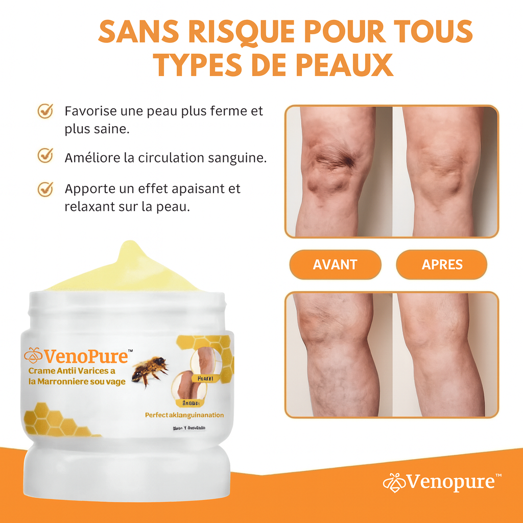 VenoPure™ Crème Anti-Varices à la Marronnière Sauvage | Fait disparaître les varices dès la 1ère application!