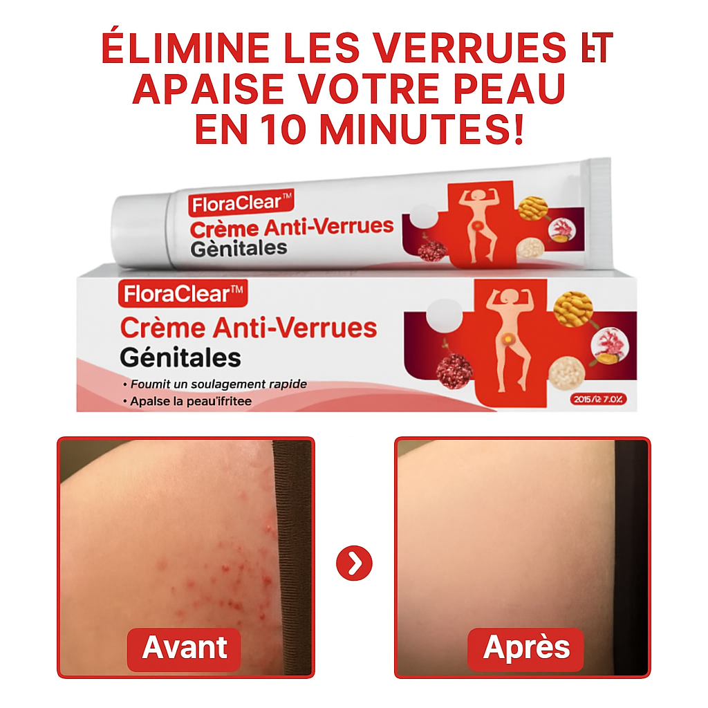 FloraClear™ Crème Anti-Verrues Génitales | Élimine les verrues et apaise votre peau en 10 minutes!