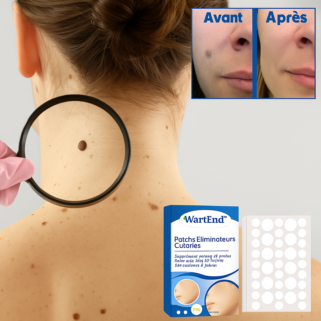 WartEnd™ Patchs Éliminateurs Cutanés | Suppriment verrues et grains de beauté jusqu’à 98 % en seulement 2 jours!