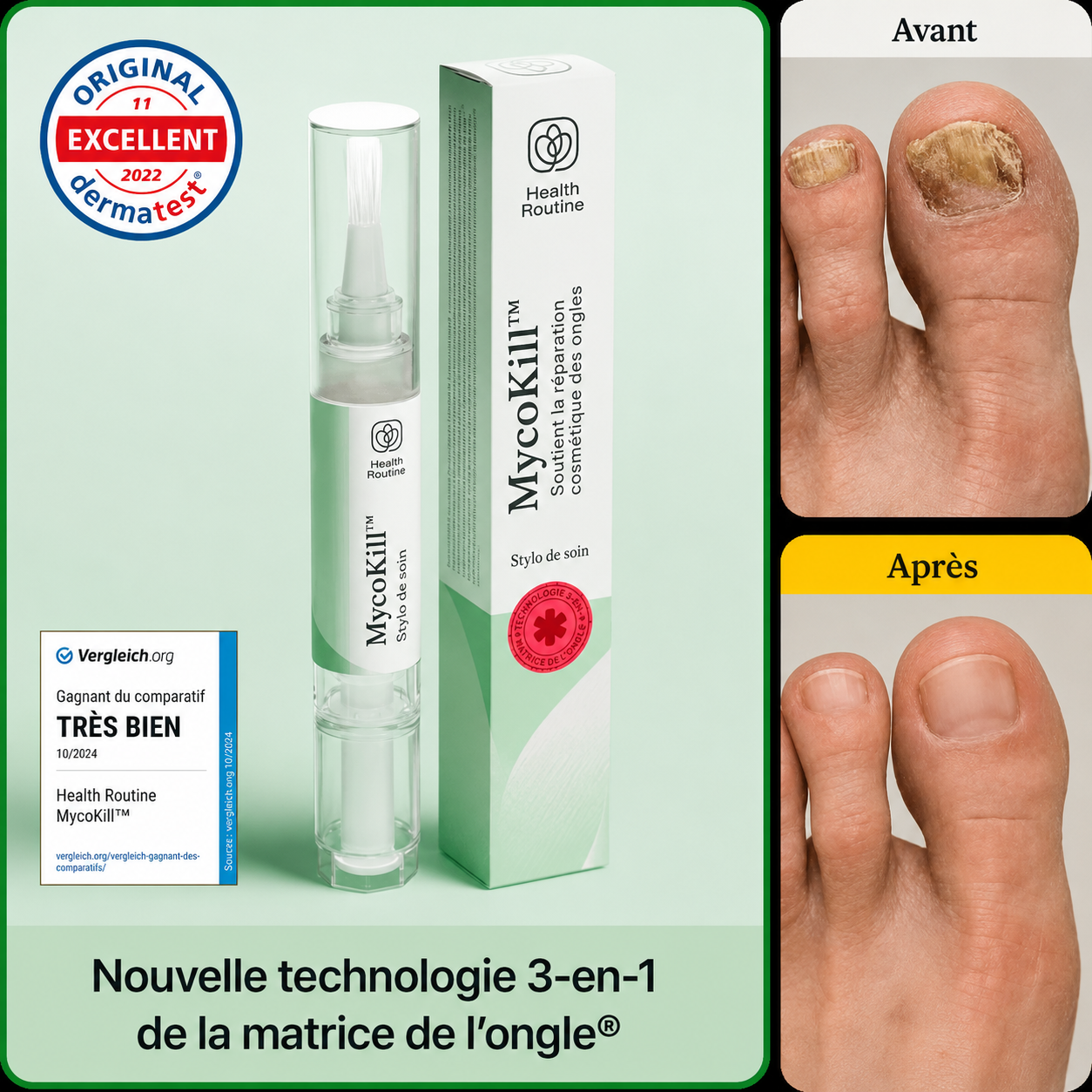 MycoKill™ Stylo Anti-Mycose des Ongles | Détruit la mycose et restaure des ongles sains en 3 semaines !
