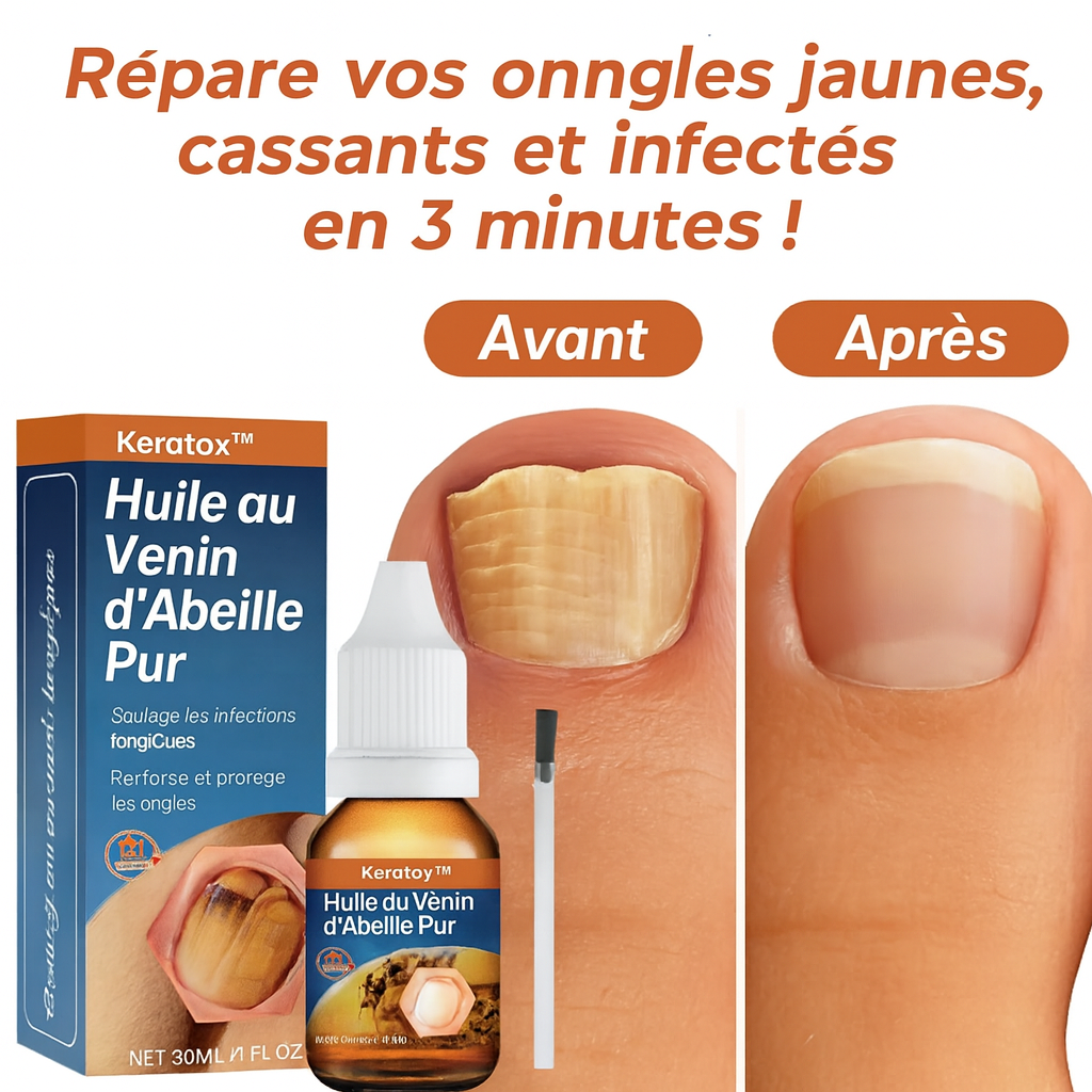 Keratox™ Huile au Venin d’Abeille Pur | Répare vos ongles jaunes, cassants et infectés en 3 minutes!
