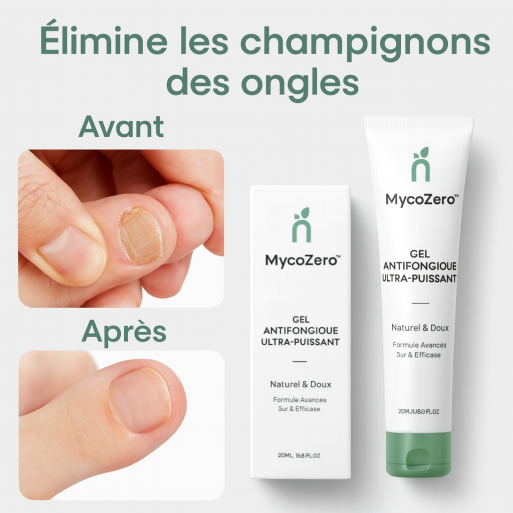 MycoZero™ Gel Antifongique Ultra-Puissant | Faites disparaître vos mycoses en 72 heures chrono!