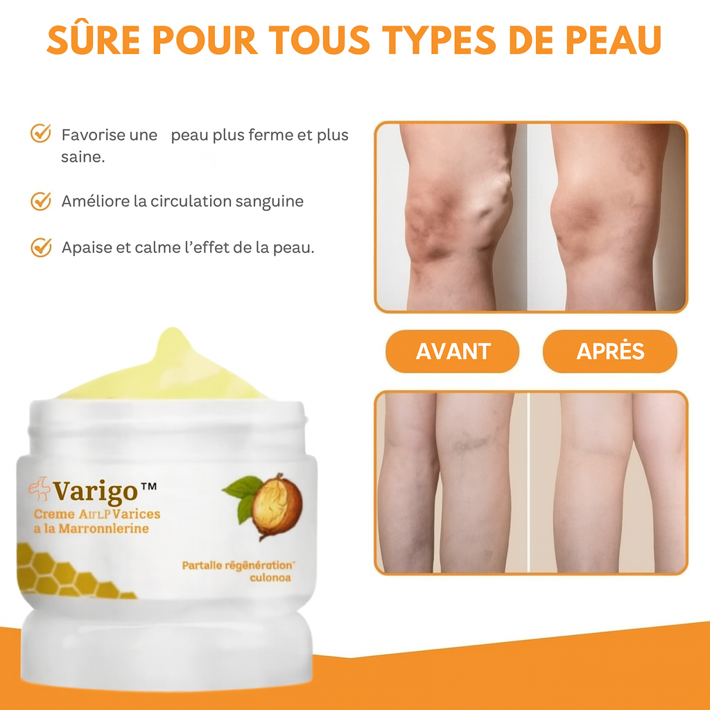 Varigo™ Crème Anti-Varices à la Marronnierine | Fait disparaître les varices dès la 1ère application!