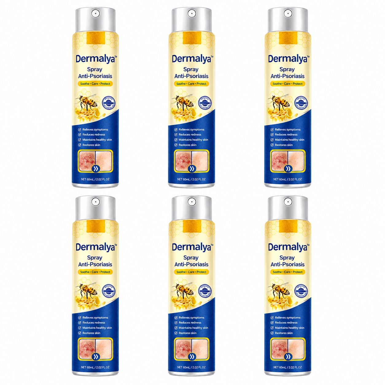Dermalya™ Spray Anti-Psoriasis | Réduit jusqu’à 95 % des plaques et démangeaisons en quelques semaines !