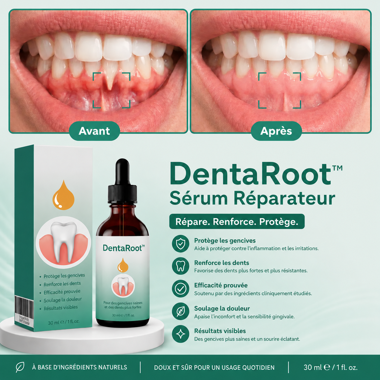 DentaRoot™ Sérum Réparateur | Stoppez la rétractation et sauvez vos dents en seulement 4 jours !