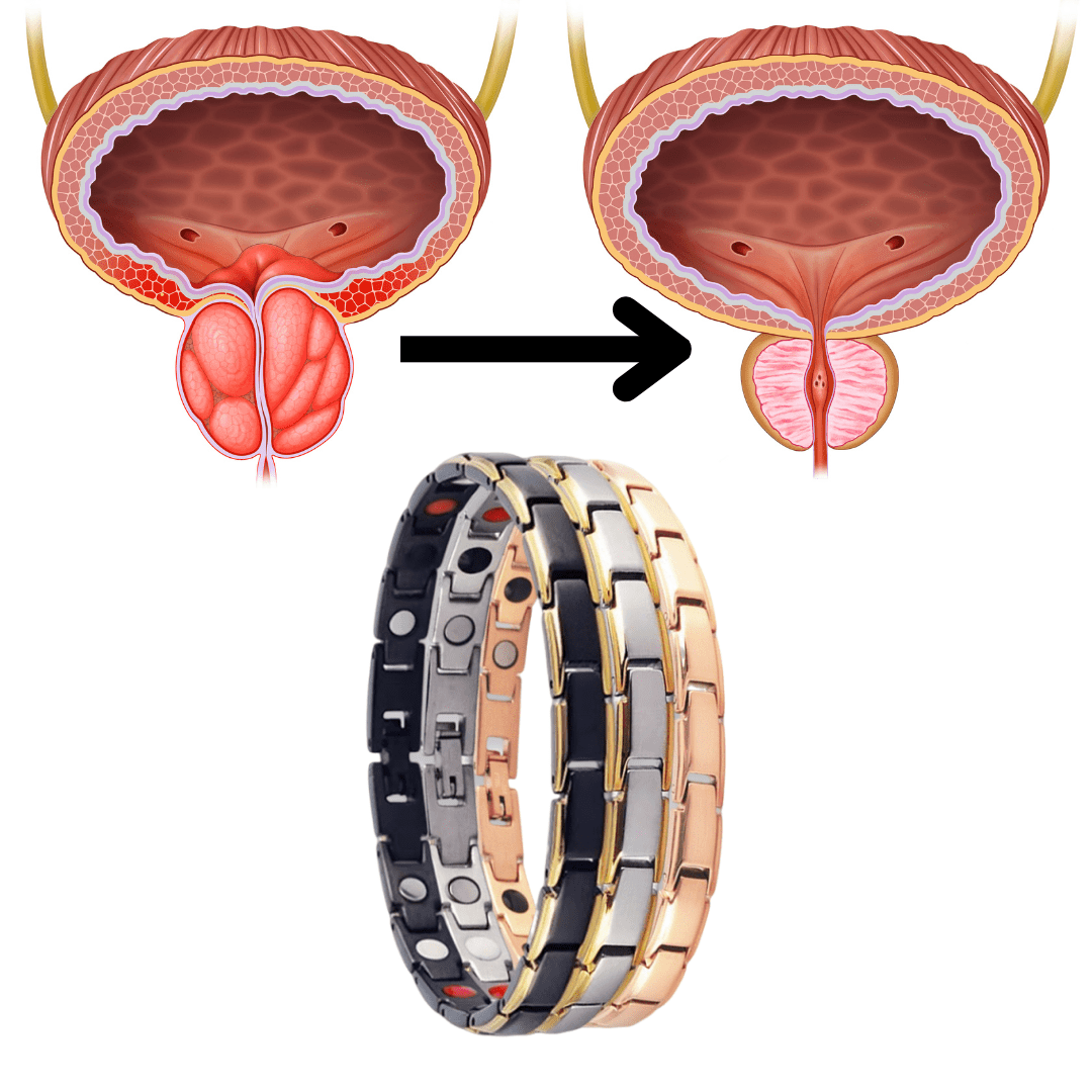 Biancat™ Bracelet de thérapie magnétique | Retrouvez une érection en 3 minutes!