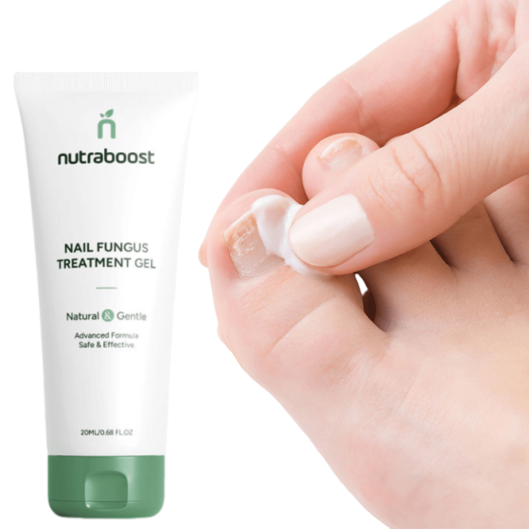 NutraBoost™ Gel de traitement contre les mycoses des ongles | Élimine rapidement les mycoses des ongles!
