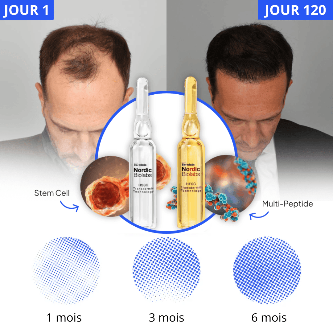 Solution Repousse Capillaire STEM Cell 2.0 de Nordic Biolabs™ | Faites repousser vos cheveux en 120 jours ou votre argent est remboursé !