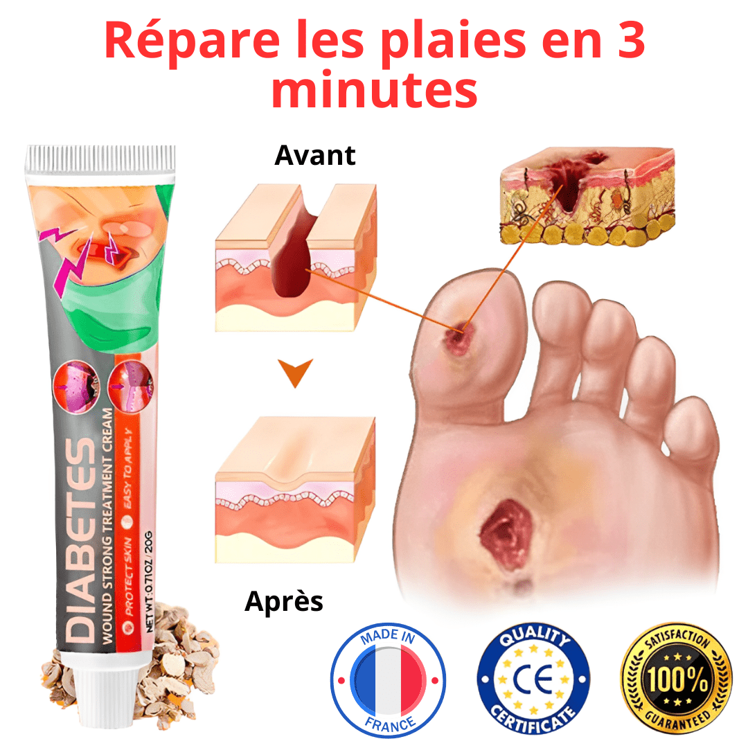 Ceoerty™ Crème traitement pour diabétiques | Répare les plaies en 3 minutes!