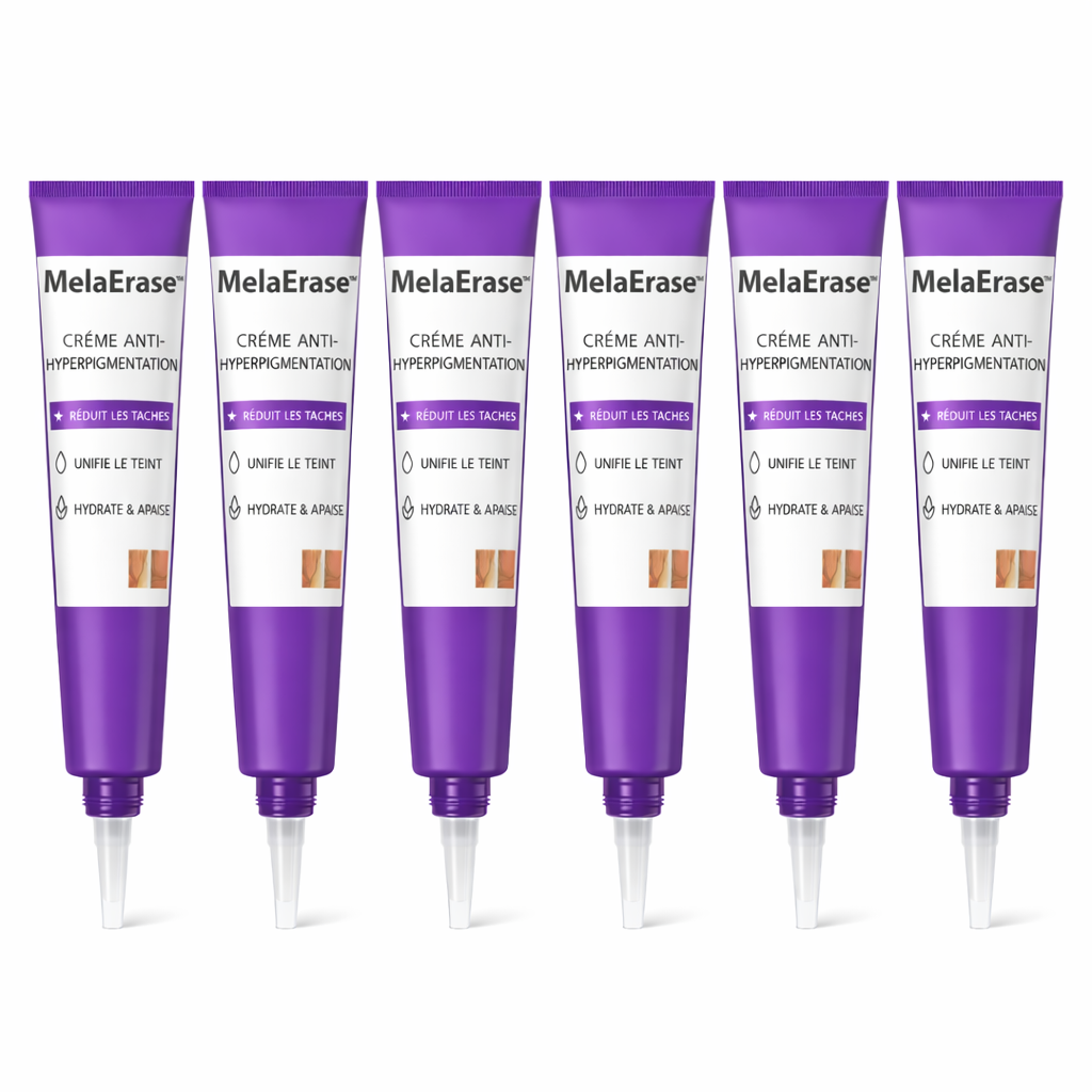 MelaErase™ Crème Anti-Hyperpigmentation | Éliminez taches brunes et unifiez votre peau rapidement !