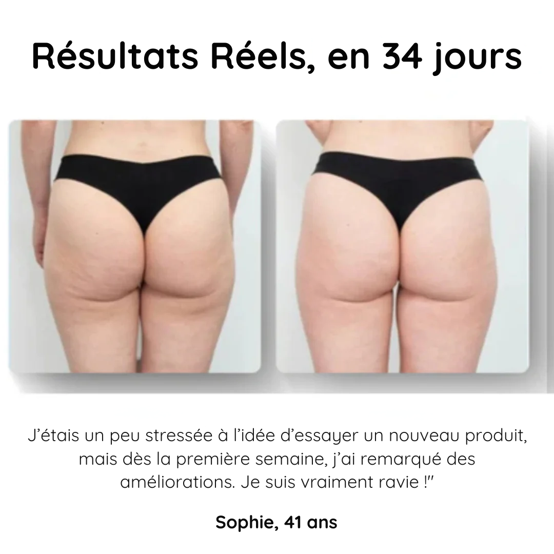 HelveTone™ - Masseur Anti-Cellulite