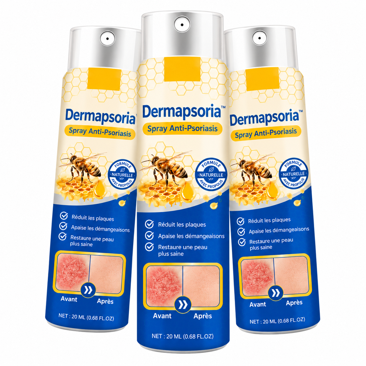 Dermapsoria™ Spray Anti-Psoriasis | Réduit jusqu’à 95 % des plaques et démangeaisons en quelques semaines !