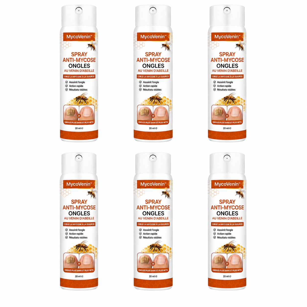 MycoVenin™ Spray Anti-Mycose Ongles au Venin d’Abeille | Ciblez la mycose à la racine et retrouvez des pieds propres !