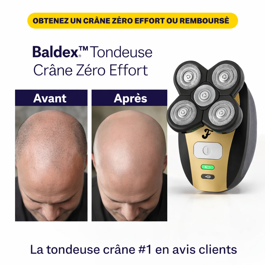 Baldex™ Tondeuse Crâne Zéro Effort | Retrouvez une tête parfaitement rasée en 3 minutes !