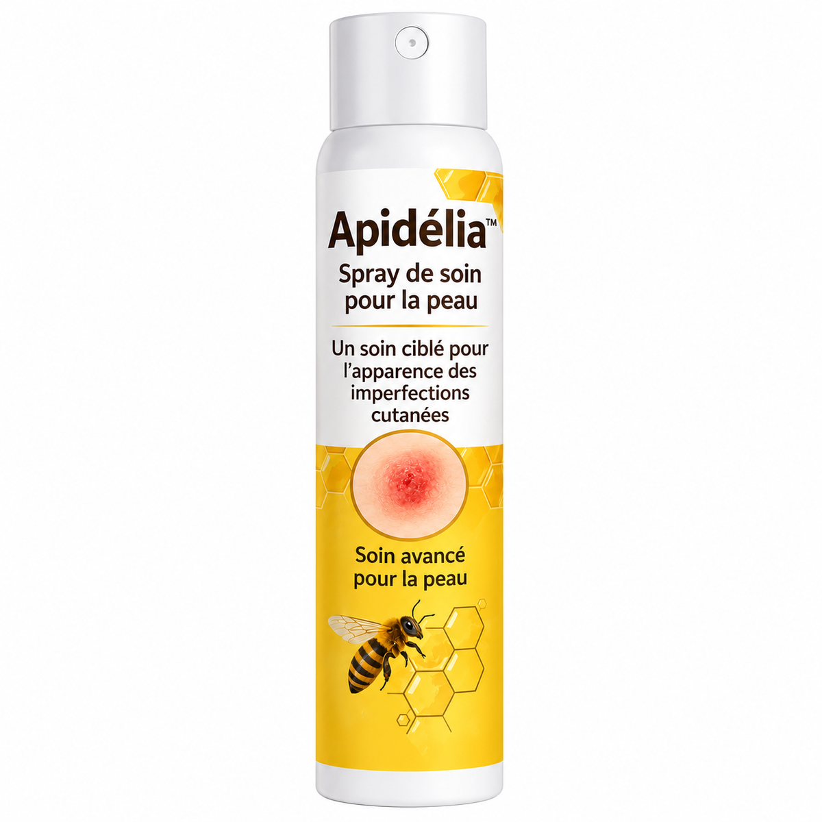 Apidélia™ Spray Peau au Venin d’Abeille | Faites disparaître vos verrues, taches et boutons en 10 minutes !