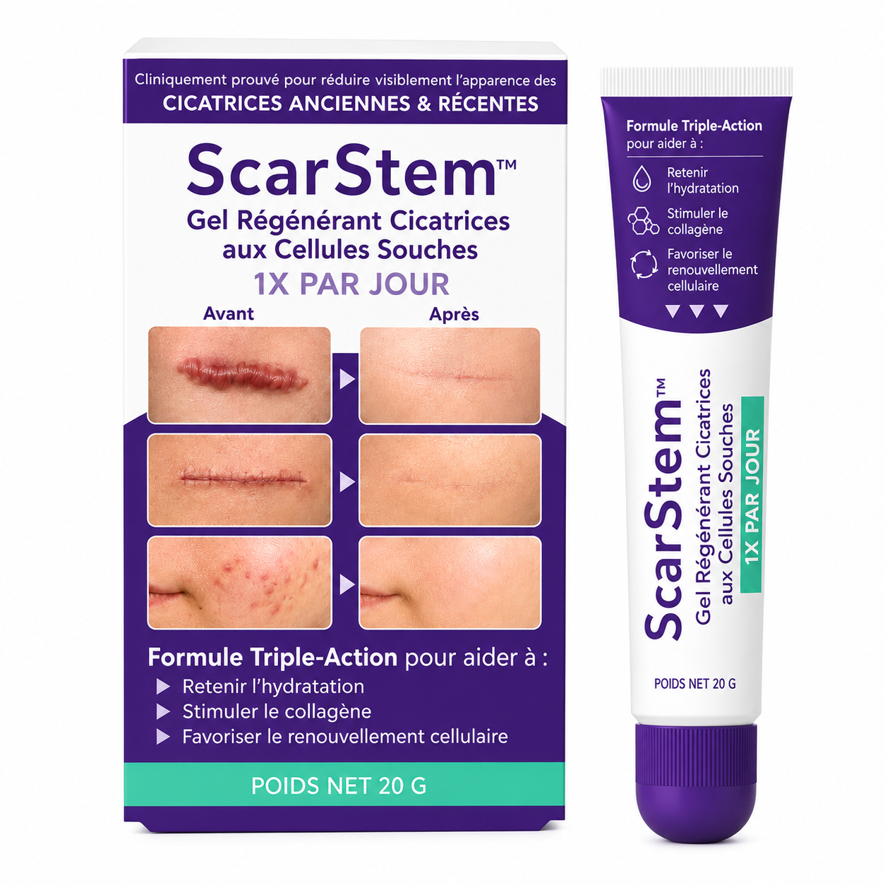 ScarStem™ Gel Régénérant Cicatrices aux Cellules Souches | Effacez cicatrices, brûlures et vergetures en 7 jours !