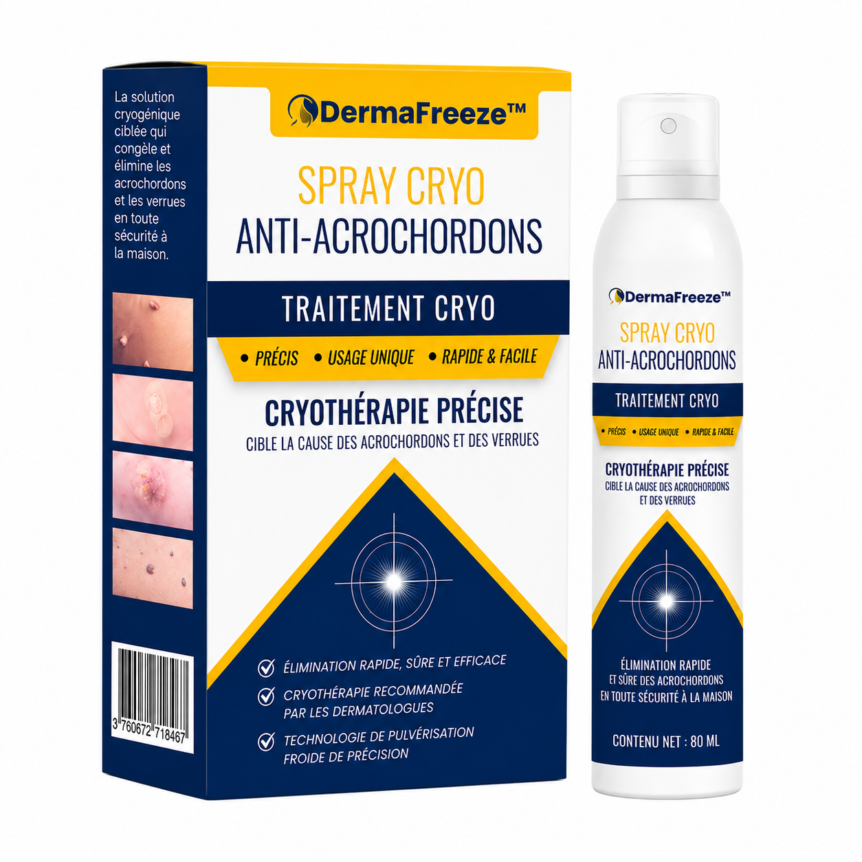 DermaFreeze™ Spray Cryo Anti-Acrochordons | Faites disparaître verrues et petites excroissances sans rendez-vous ni chirurgie !