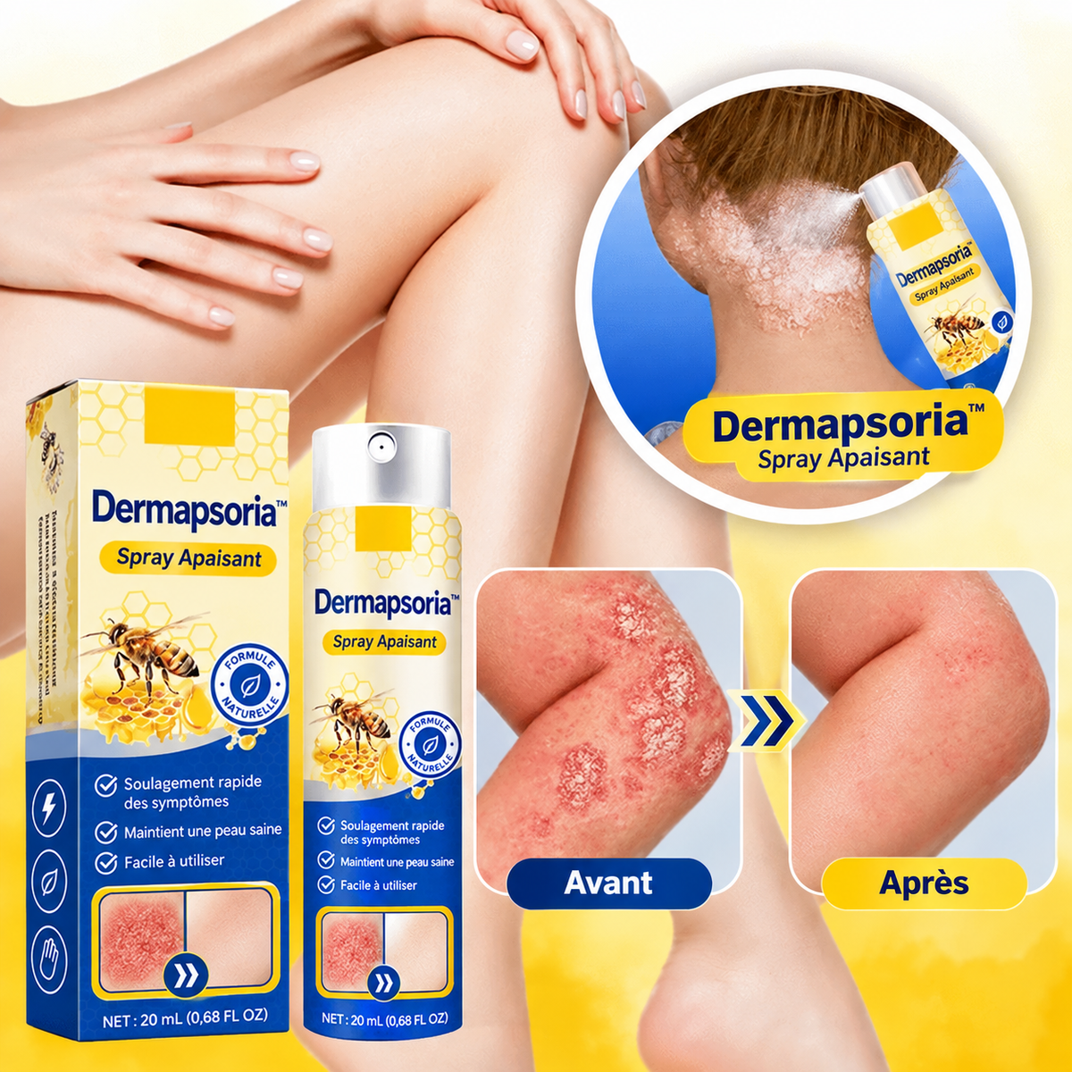 Dermapsoria™ Spray Anti-Psoriasis | Réduit jusqu’à 95 % des plaques et démangeaisons en quelques semaines !