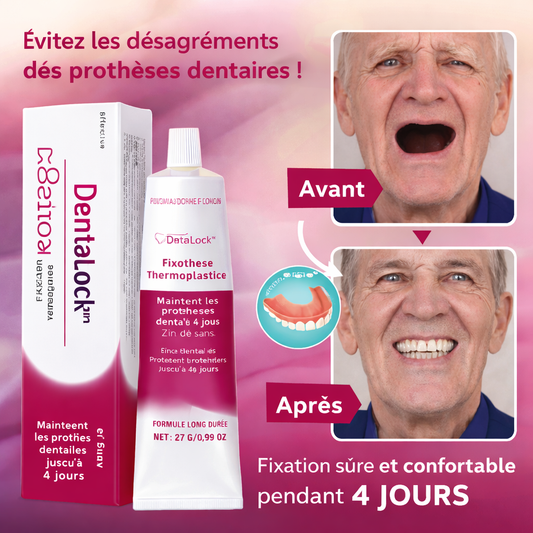 DentaLock™ Fixateur Prothèse | Stabilisez vos dents et retrouvez confiance en 30 secondes !