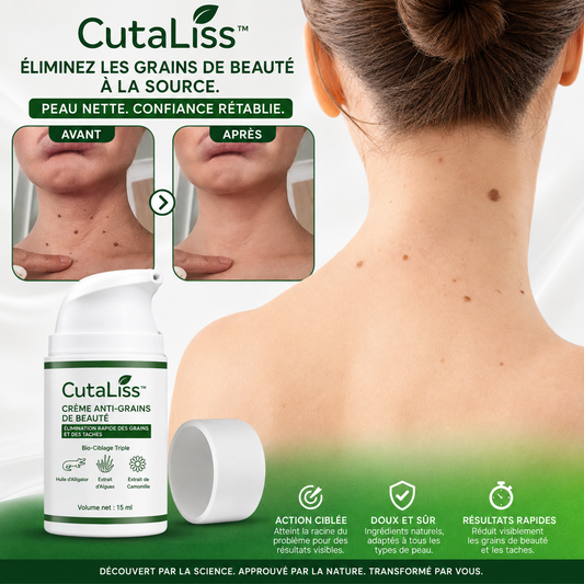 CutaLiss™ Crème Anti-Acrochordons & Grains de Beauté | Ciblez les petites excroissances à la racine et retrouvez une peau plus lisse !