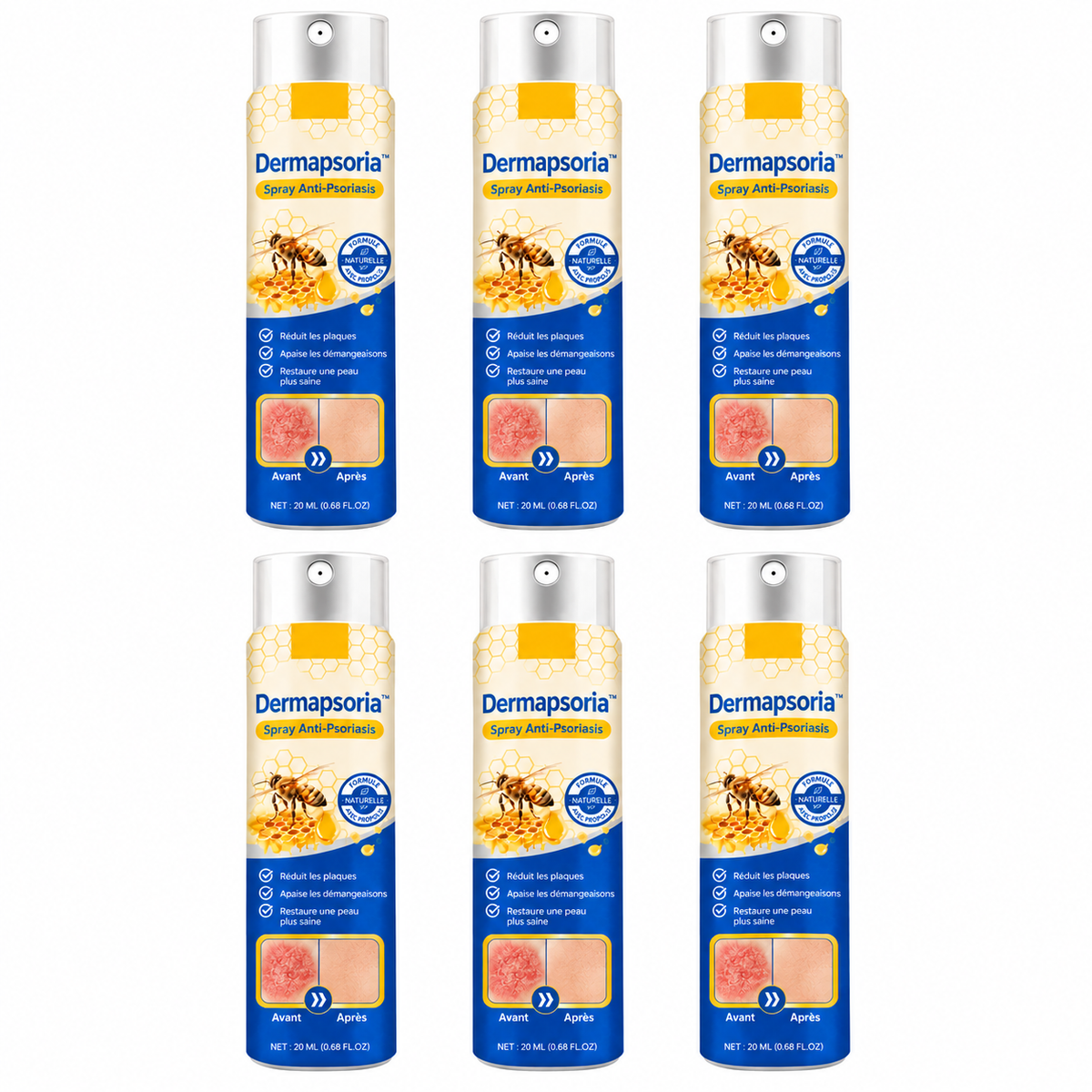 Dermapsoria™ Spray Anti-Psoriasis | Réduit jusqu’à 95 % des plaques et démangeaisons en quelques semaines !