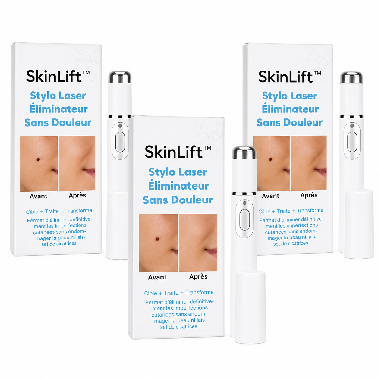 SkinLift™ Stylo Laser Éliminateur Sans Douleur | Efface les verrues et grains de beauté dès la 1ère utilisation!