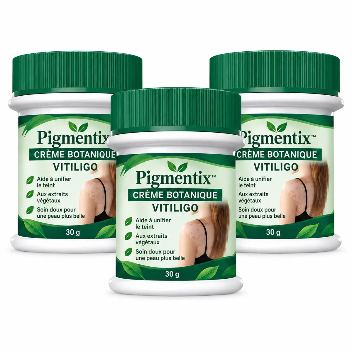 Pigmentix™ Crème Botanique Vitiligo | Réduisez l’apparence des taches blanches et retrouvez un teint plus uniforme sans maquillage épais !