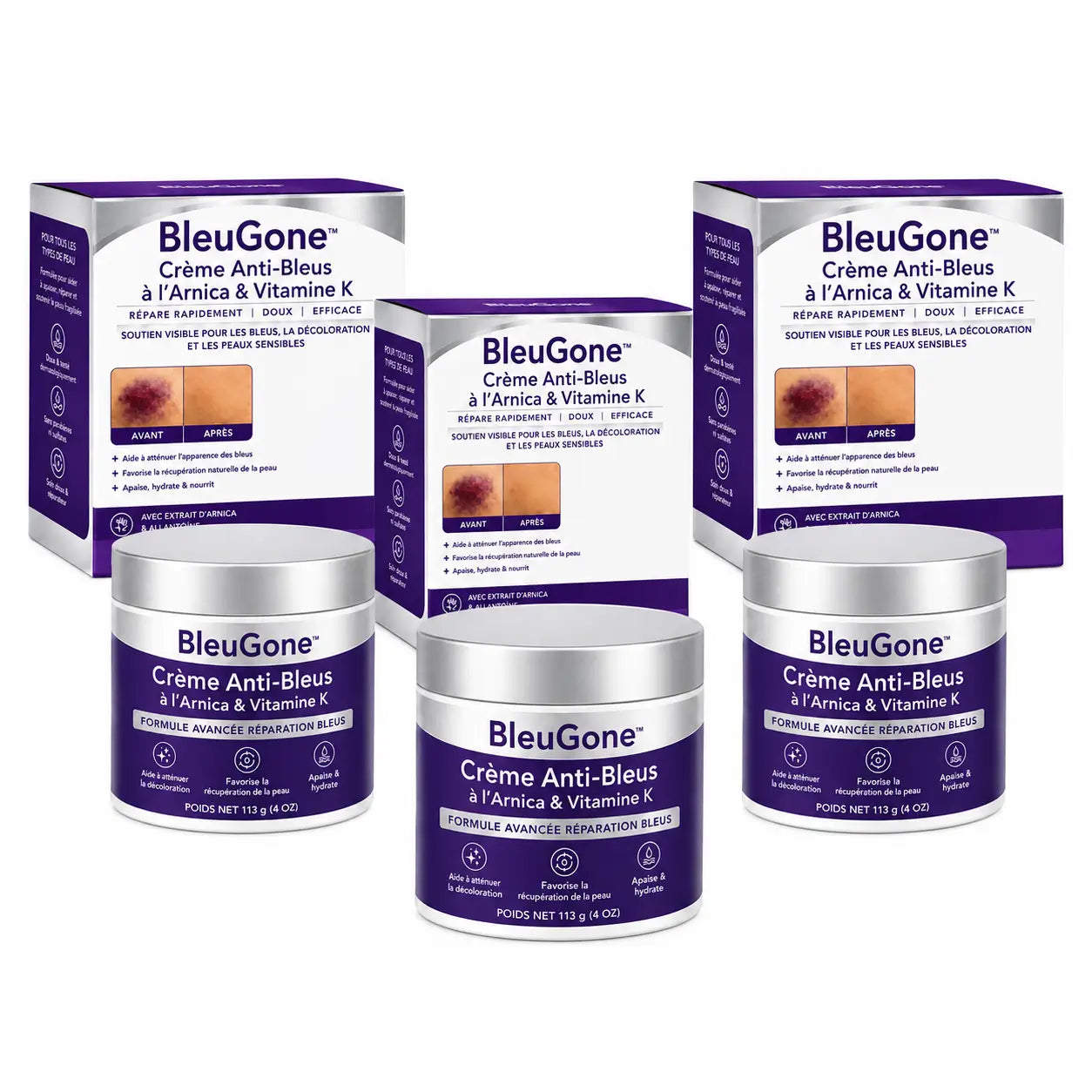 BleuGone™ Crème Anti-Bleus à l’Arnica & Vitamine K | Faites disparaître l’apparence des bleus, marques et taches sans crème grasse !