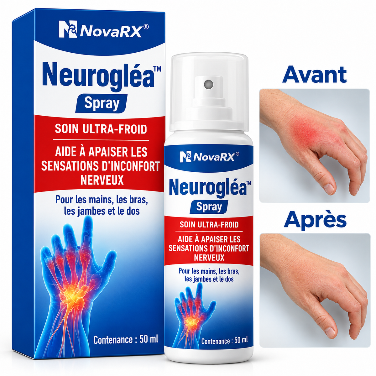 Neurogléa™ Spray Anti-Neuropathie Ultra-Froid | Stoppe les douleurs nerveuses en moins de 2 minutes!