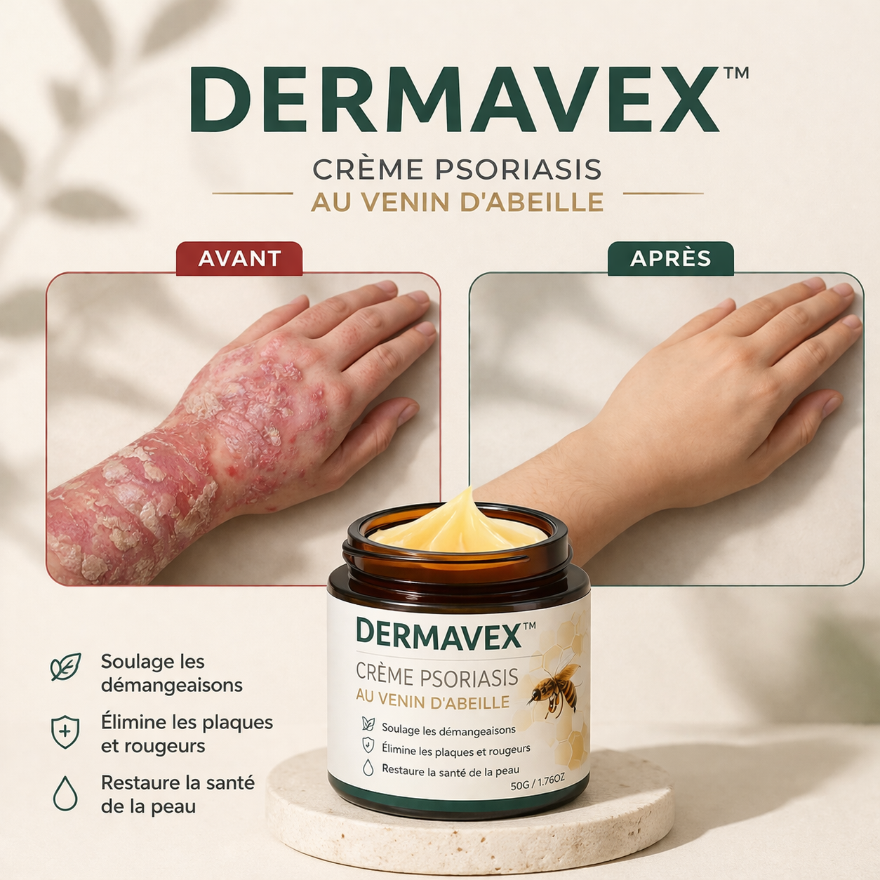 Dermavex™ Crème Psoriasis au Venin d’Abeille | Éliminez plaques, démangeaisons et rougeurs en quelques minutes !