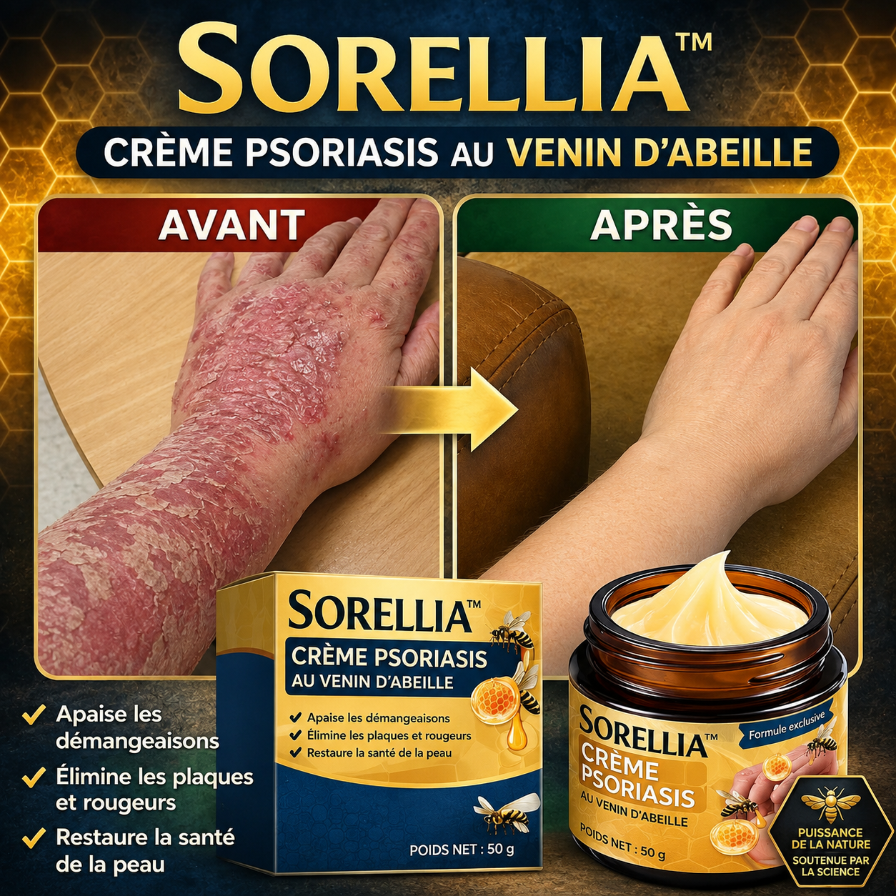 Sorellia™ Crème Psoriasis au Venin d’Abeille | Éliminez plaques, démangeaisons et rougeurs en quelques minutes !