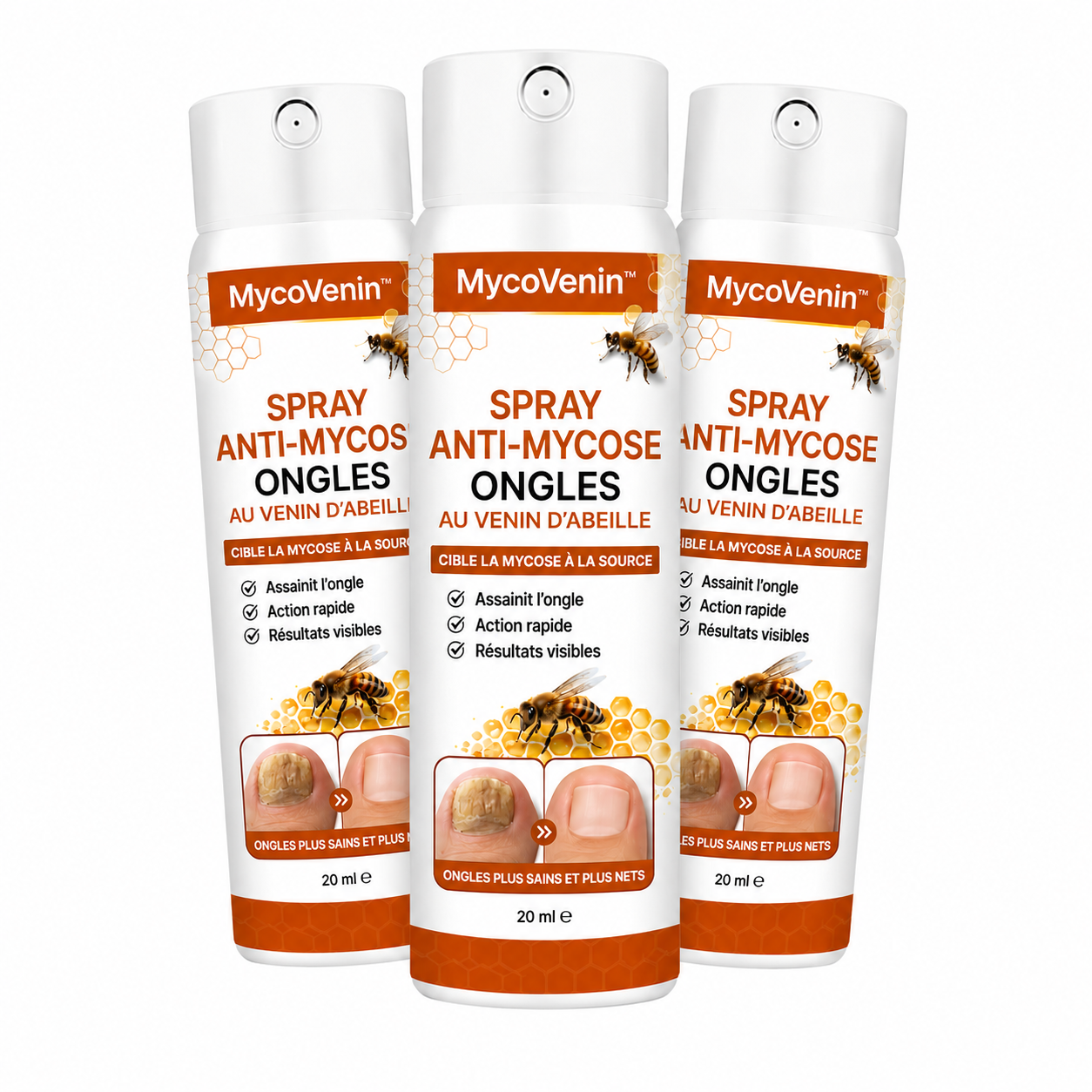 MycoVenin™ Spray Anti-Mycose Ongles au Venin d’Abeille | Ciblez la mycose à la racine et retrouvez des pieds propres !