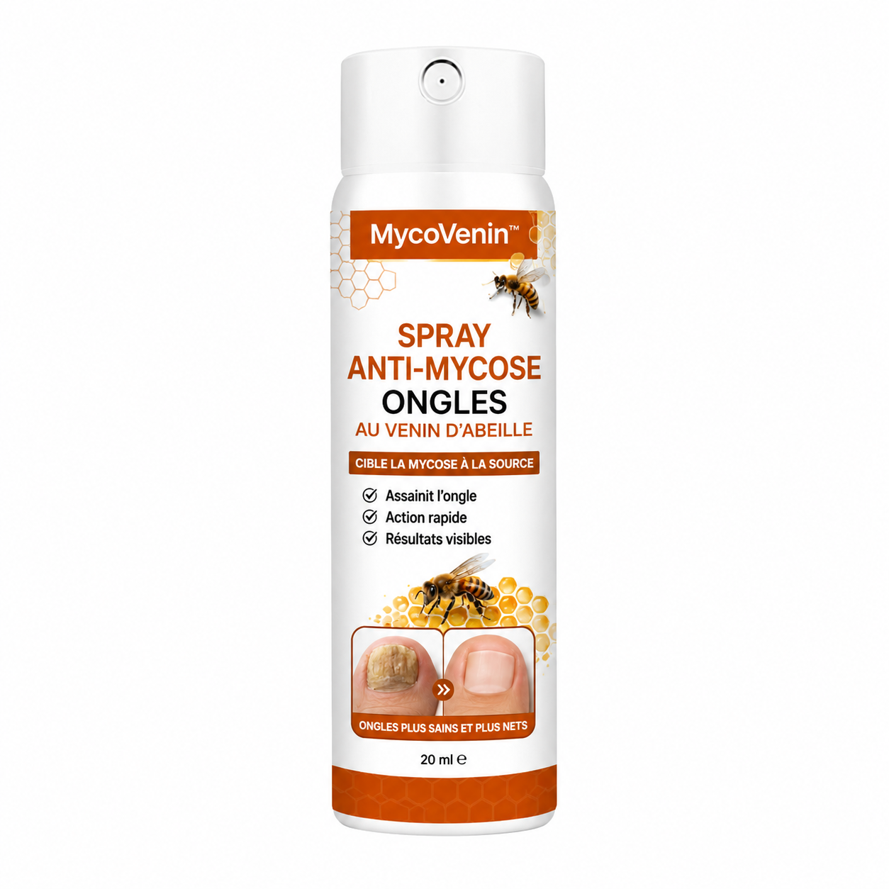 MycoVenin™ Spray Anti-Mycose Ongles au Venin d’Abeille | Ciblez la mycose à la racine et retrouvez des pieds propres !