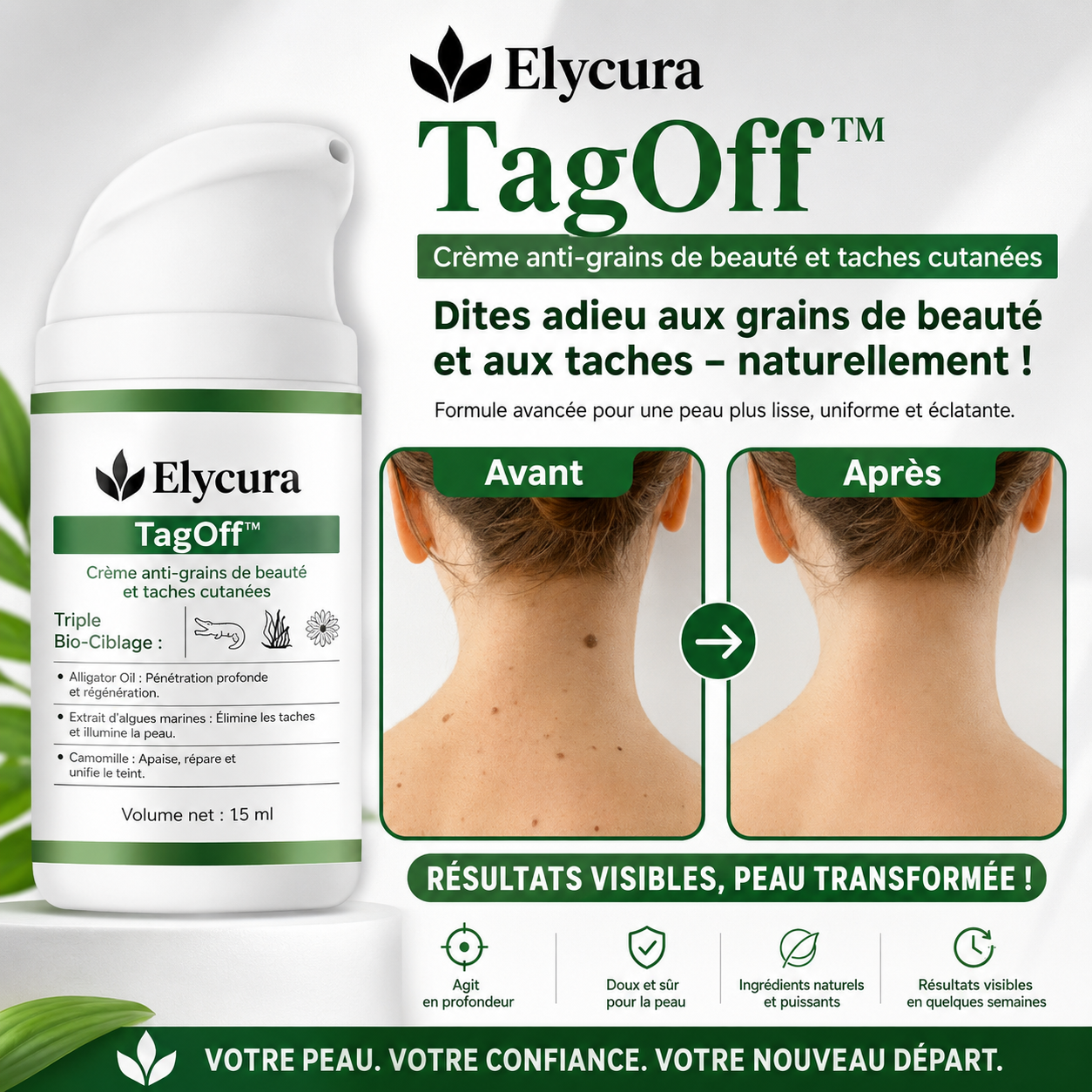 TagOff™ Crème Ciblée Anti-Grains de Beauté & Acrochordons | Retrouvez une peau lisse en 7 jours, sans chirurgie, sans laser ni facture dermatologue !