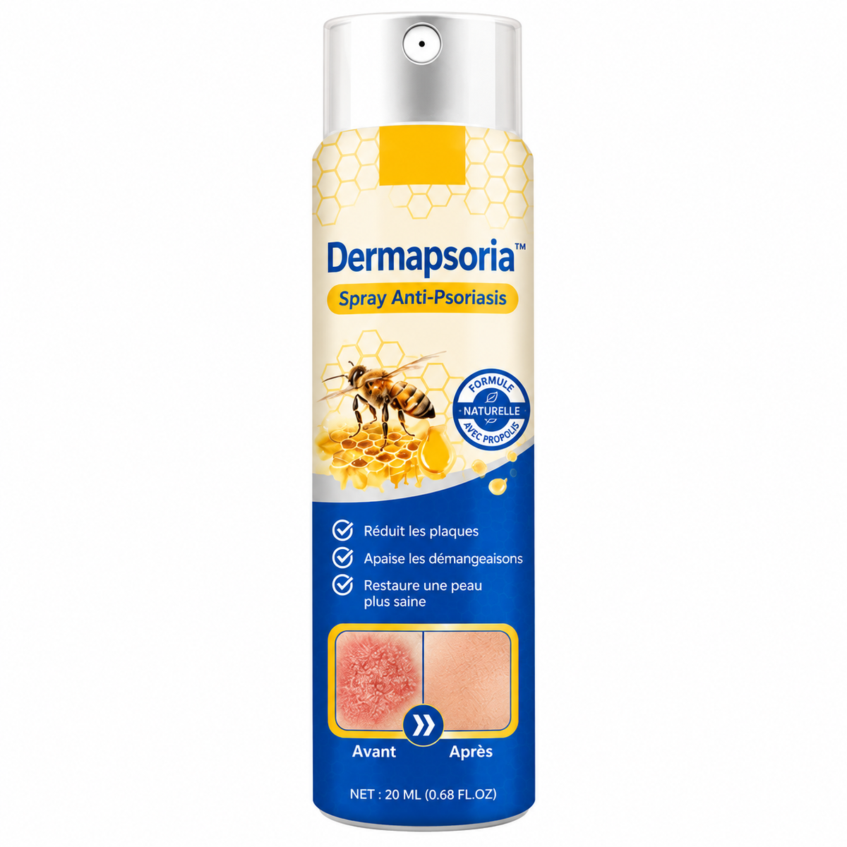 Dermapsoria™ Spray Anti-Psoriasis | Réduit jusqu’à 95 % des plaques et démangeaisons en quelques semaines !