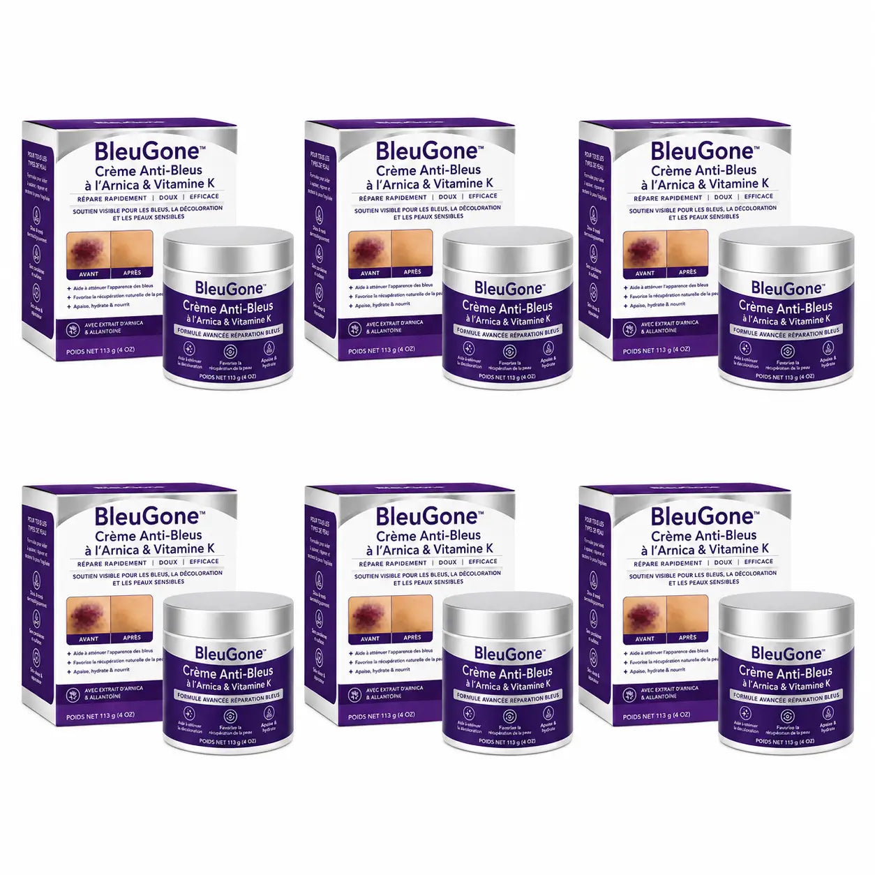 BleuGone™ Crème Anti-Bleus à l’Arnica & Vitamine K | Faites disparaître l’apparence des bleus, marques et taches sans crème grasse !